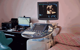 原装进口GEE8彩超