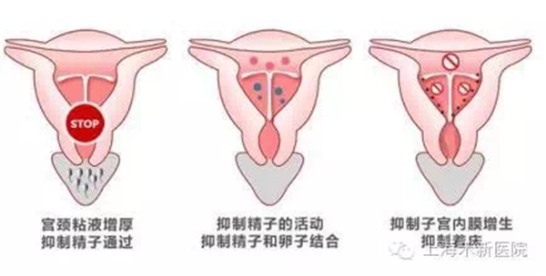 微信图片_20170705171314.jpg 微信图片_20170705171314.jpg