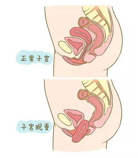 11.jpg 11.jpg